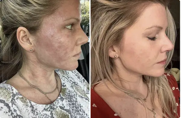 Before and after comparison - 10 Weeks