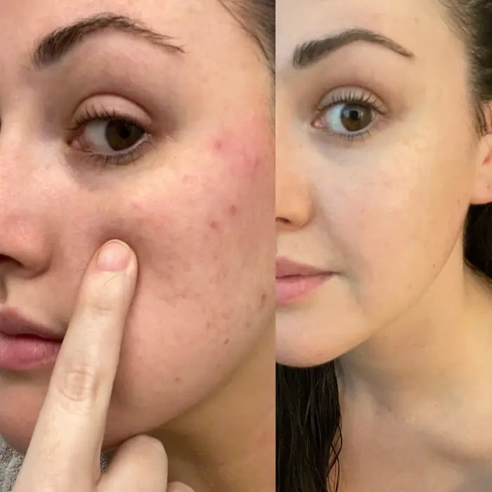 Before and after comparison - 8 Weeks
